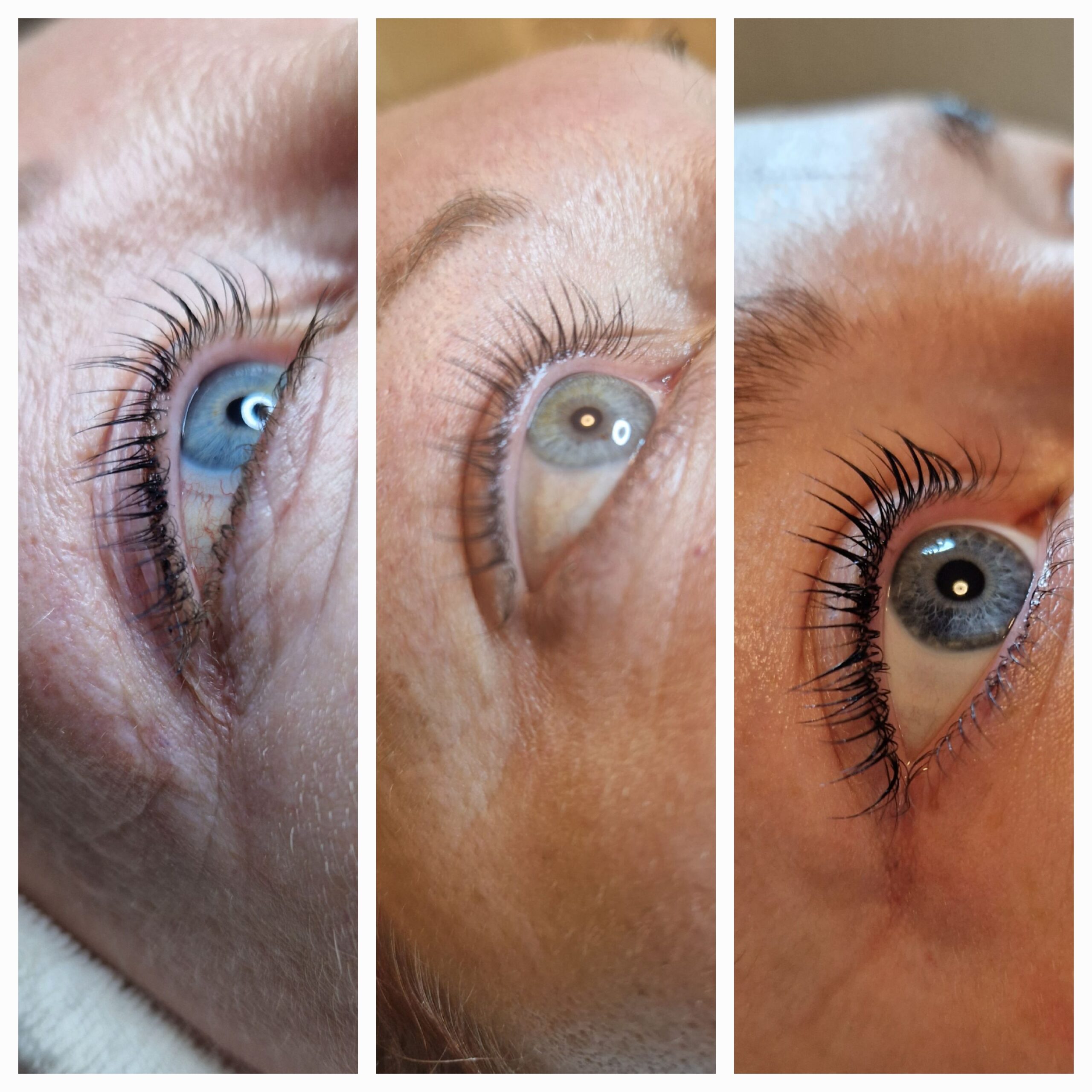 Beauty treatment example